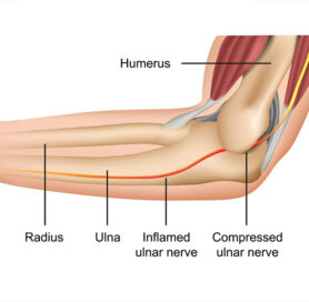 Anatomy of The Elbow Muscle