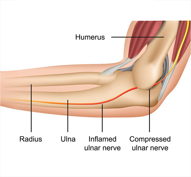An illustration of internal arm joint parts