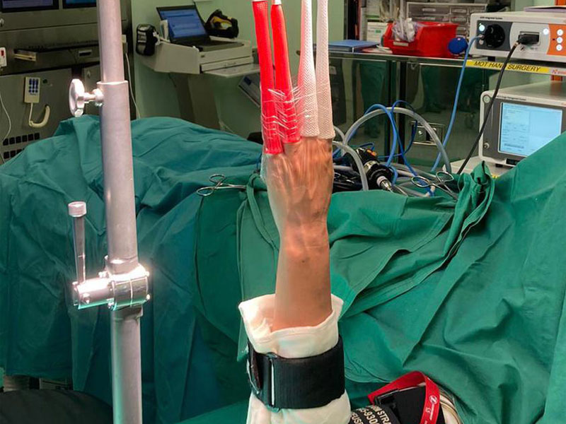 A hand undergoing an operation