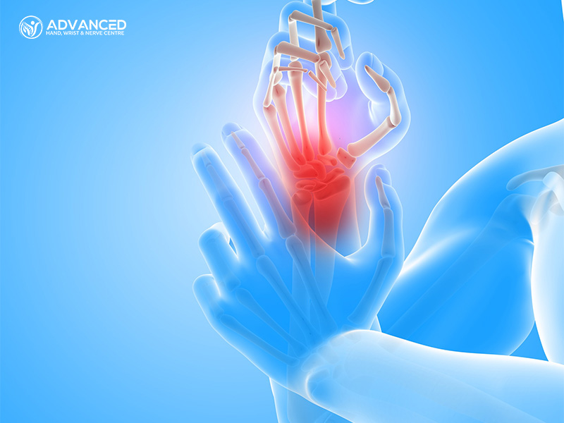  Do not let carpal tunnel syndrome hold you back-hand and wrist specialist Singapore