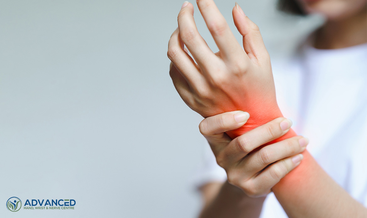 3 Common Types Of Wrist Arthritis & The Treatment Options