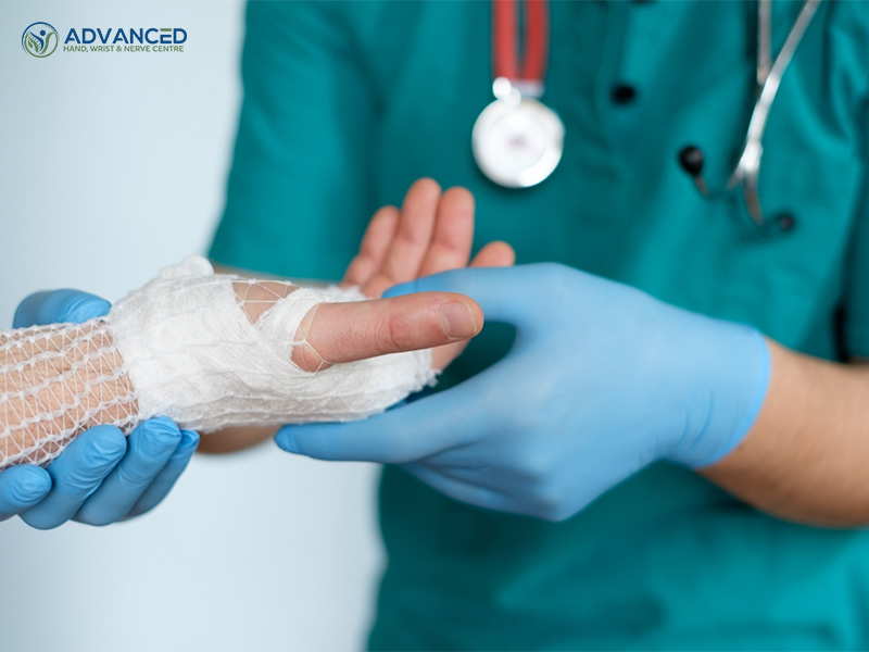 Essential tips to safeguard against infection after hand surgery