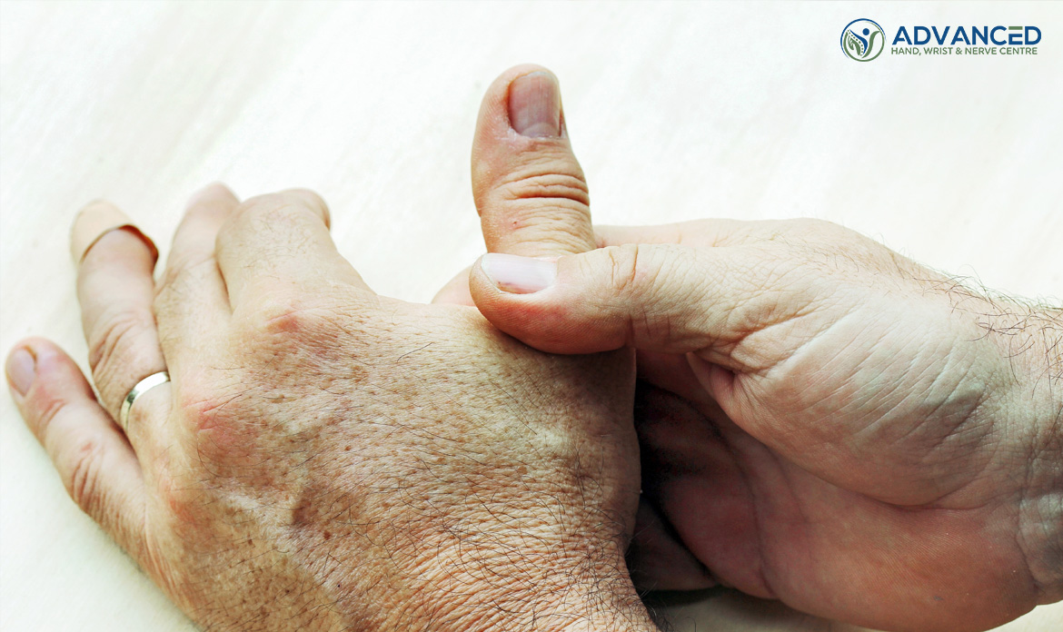 Guide To Basal Thumb Arthritis Causes Symptoms & Treatments