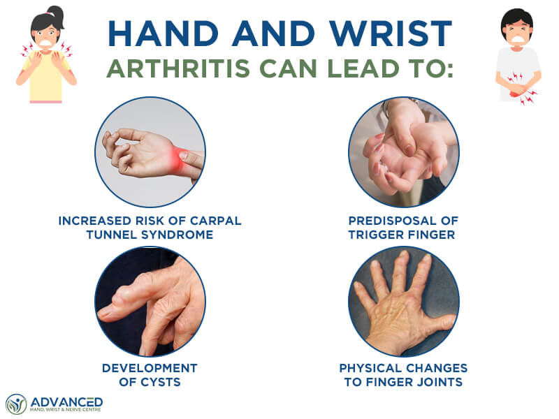 A Guide To Hand And Wrist Arthritis Hand Surgery Singapore Advanced 