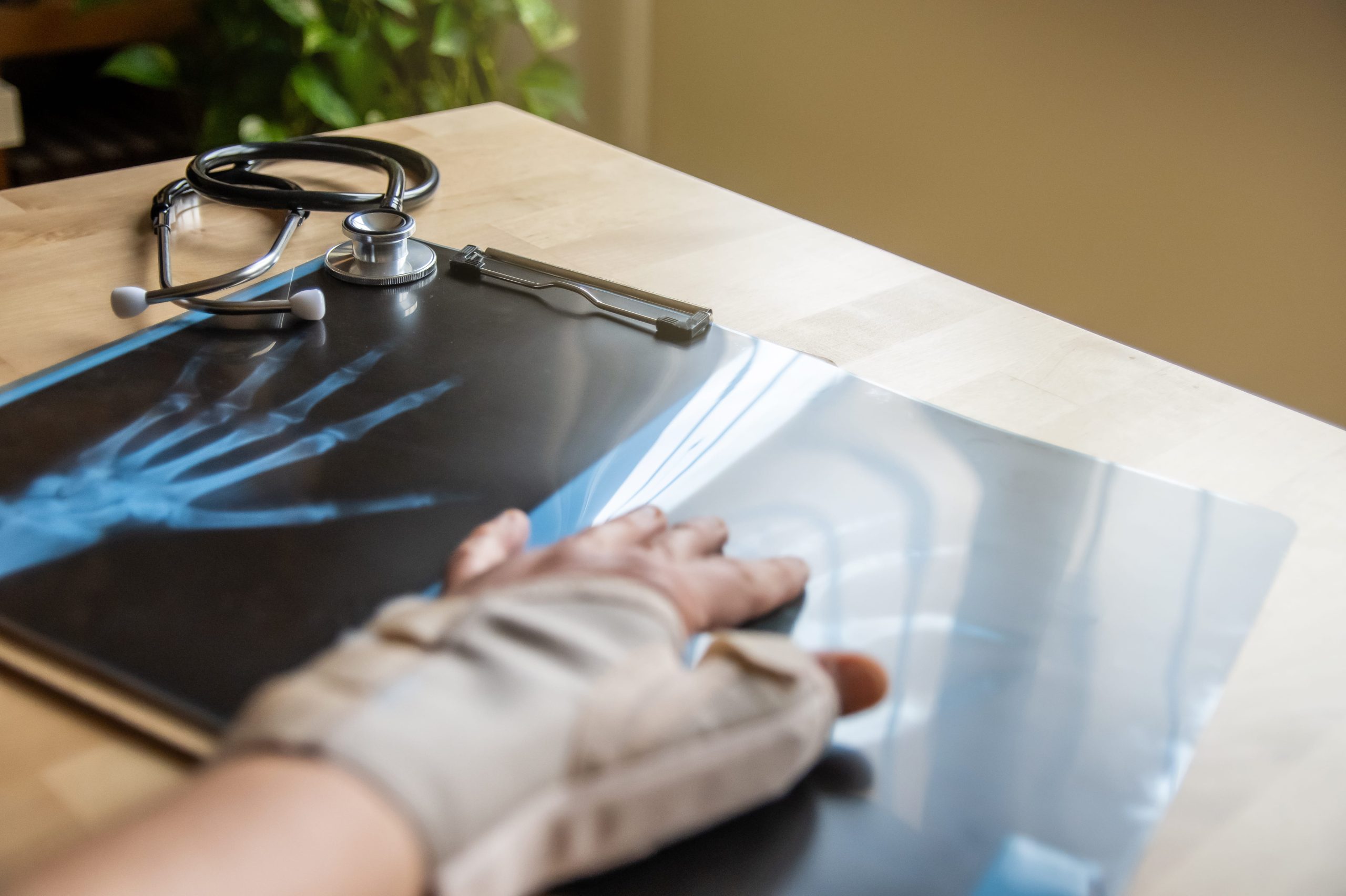 Image hand examining x ray with stethoscope in office 2026 03 26 03 27 57 utc (1)