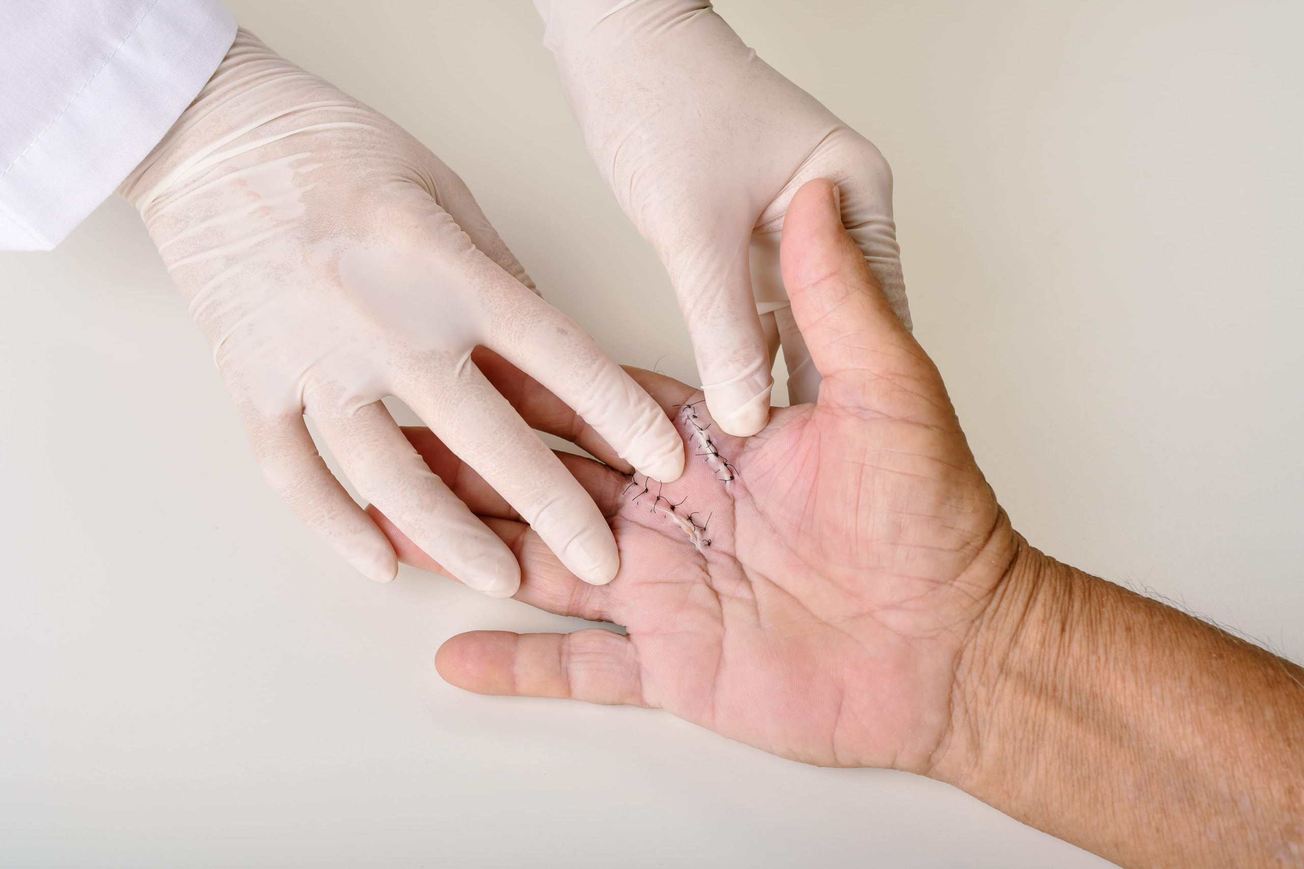 Image medical professional examining sutured wound on pa 2026 03 17 14 48 33 utc (1)